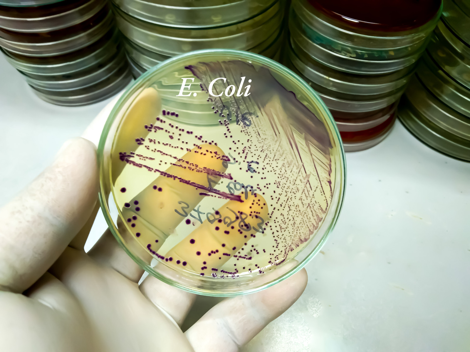 E.coli Detection In Water